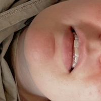 Алліріадсхсмут Оголені