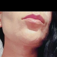 аурорабіанко Оголені