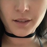 Нісевайдхофер Оголені