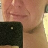 Нотсопосі Оголені