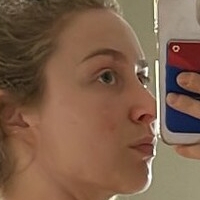 Супорсоник_ Оголені